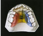 Зубы, пластмассы «Polident»