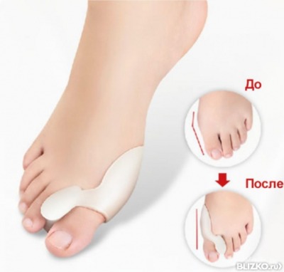 Фиксатор Valgus Pro Medicus от косточки на большом пальце стопы