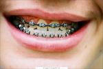 Материалы стоматологические