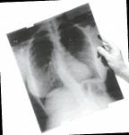Рентгеновская пленка Retina