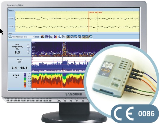 Монитор церебральных функций «Энцефалан-ЦФМ»